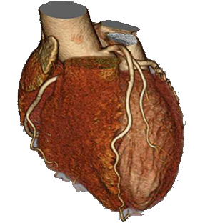 Heart tomograph image